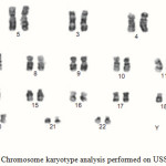 Figure 7: Chromosome karyotype analysis performed on USSC