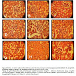 Figure 5. Cortical and central sections of the adult male wistar rat kidneys belong to control group (A), sham (B), Antibiotic (C), Group 1 (D), Group 2 (E), Group 3 (F), Group 4 (G), Group 5 (H), Group 6 (I) (hematoxylin-eosin, × 400) *Group 1: Ag/ZnO Nanoparticle (32µgml-1), Group 2: Ag/ZnO Nanoparticle (32µgml-1) + Antibiotic (Ciprofloxacin), Group 3: Ag/ZnO Nanoparticle (128µgml-1), Group 4: Ag/ZnO Nanoparticle (128µgml-1) + Antibiotic (Ciprofloxacin), Group 5: Ag/ZnO Nanoparticle (512 µgml-1), Group 6: Ag/ZnO Nanoparticle (512 µgml-1) + Antibiotic (Ciprofloxacin)