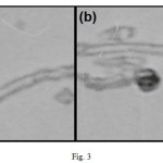 Fig. 3: TEM images for MWCNT–COOH (a) and ANSA functionalized MWCNTs (b).