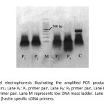 Fig. 2Agarose gel electrophoresis illustrating the amplified PCR product with different specific primer pairs; Lane P1: P1 primer pair, Lane P2: P2 primer pair, Lane P3: P3 primer pair and Lane P4: P4 primer pair. Lane M represents low DNA mass ladder. Lane C represents the PCR product with β-actin specific cDNA primers.