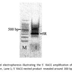 Fig. 8 Agarose gel electrophoresis illustrating the 5´ RACE amplification of Mb cDNA; Lane M: low DNA ladder, Lane 1; 5´ RACE nested product revealed around 300 bp.