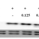 Figure 5: RFE inhibitory effects on ERK expression in LPS-stimulated RAW264.7 murine macrophage. Cells (1.5 x 106 cells/mL) were pre-incubated for 18 h and then treated with LPS (1 μg/mL) and RFE for 15 min. p-ERK and ERK protein levels were determined by western blotting.