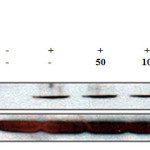 Figure 2: Effect of Euphorbiahelioscopiaon the protein level of iNOS in LPS-treated RAW 264.7 cells. RAW 264.7 cells (6.0 × 105 cell/mL) treated with LPS (1 µg/mL) in the presence of E. helioscopia(50 to 200 µg/mL) for 24 h. Whole-cell lysates (30 µg) were prepared, protein was subjected to 8% SDS-PAGE, and expression of iNOS and control β-actin was determined by western blotting. 