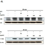 Figure 6: Effect of Euphorbiahelioscopia on the phosphorylation of JNK (A) and ERK(B) in LPS-treated RAW 264.7 cells.RAW 264.7 cells (1.0×106 cells/mL) were treated with LPS (1 µg/mL) in the presence of E. helioscopia (50 to 200 µg/mL) or inhibitors (40 µM) for 20 minutes. Whole cell lysates (30 µg) were prepared, protein was subjected to 10% SDS-PAGE, and expression of p-JNK, p-ERK and control β-actin was determined by western blotting. SP600125 (SP): JNK inhibitor, PD98059 (PD): ERK inhibitor.