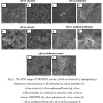 Figure 1: The SEM image of UHMWPE powder, which is obtained by impregnating a dispersion in the reduction of silver laurate (a), silver palmitate (c), silver nitrate (e), silver methanesulfonate (g), silver trifluoroacetate (i); obtained by reduction with of silver laurate UHMWPE (b), silver palmitate (d), silver nitrate (f), silver methanesulfonate (h), silver trifluoroacetate (j)