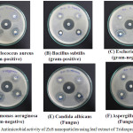 Figure 5:  Antimicrobial activity of ZnS nanoparticles using leaf extract of Tridaxprocumbens