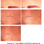 Figure 3: The effect of KGEA extract at concentration 250μgmL-1 on the scratch closing of C33A cells  from day 1 to day 8