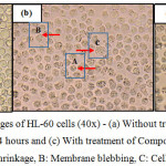 Figure 7: Morphological changes of HL-60 cells (40x) - (a) Without treatment, (b) With treatment of Compound 1 for 24 hours and (c) With treatment of Compound 2 for 24 hours A: Cell shrinkage, B: Membrane blebbing, C: Cell swelling 
