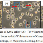 Figure 9: Morphological changes of K562 cells (40x) - (a) Without treatment, (b) With treatment of Compound 1 for 24 hours and (c) With treatment of Compound 2 for 24 hours A: Cell shrinkage, B: Membrane blebbing,C: Cell swelling