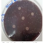 Figure 11: Antibacterial activity viridians Streptococci treated by S3 on blood agar