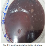 Figure 15: Antibacterial activity viridans Streptococci treated by S5 on blood agar 
