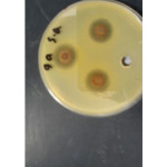 Figure 2: influence of the synthesized compound 9a on Staphylococcus aureus.