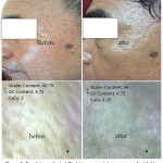 Figure 5: Panelists applicated Skeletonema costatum cream on facial skin