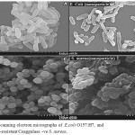 Figure 8: Scanning electron micrographs of  E.coli O157:H7, and methicillin-resistant Coaggulase -ve S. aureus.