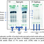 Figure 1: Electrophoretic profile of pooled crude sera and pooled crude saliva protein of the three studied groups on alkaline agarose gel films of Hellabio protein electrophoresis kit. The gels were stained with amido black in 5% acetic acid. (PDR) refer to proliferative diabetic retinopathy.