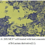 Figure 6: 20X MCF7 cell treated with best concentration of B-Lactam derivative(L1).