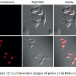 Figure 12: Luminescence images of probe 29 in Hela cells.