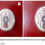 Figure 6: Photograph of antimicrobial test results of Zn-ALG against a) S.aureus and b) E.coli