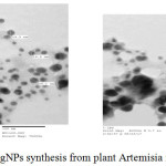 Figure 5: TEM image of AgNPs synthesis from plant Artemisia monosperma