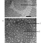 Figure 2: Morphology and liposomal lamellarity under TEM with TLH method (A) Magnification 40000 ×; (B) 80000 × magnification; 1. The lipid section; 2. The water core part