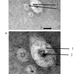 Figure 3: Morphology and liposomal lamellarity under TEM with REV method (A) Magnification 40000 ×; (B) 80000 × magnification; 1. The lipid section; 2. The water core part.