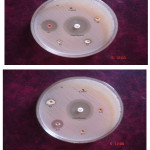 Figure 3: Antibacterial Activity of TBA, TBB, TBN and TBC (Escherichia coli).