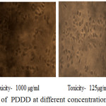 Figure 10: Anticancer activity of  PDDD at different concentration on A549 cell line.