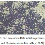 Figure 3: Cell carcinoma Hela which represents control and illustrates dense line cells, (100 X).