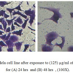 Figure 4: Hela cell line after exposure to (125) µg/ml of LBe ligand for (A) 24 hrs and (B) 48 hrs, (100X).