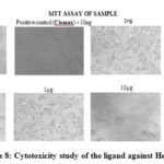  Figure 8: Cytotoxicity study of the ligand against Hep G2