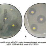 Figure 4: Antibacterial activity of AgNPs against human pathogenic microorganisms