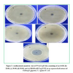 Figure 5: Antibacterial sensitivity test of PVA-Cu2O NFs consisting of (a) 10.00, (b) 20.00, (c) 30.00, (d) 50.00, and (e) 100.00